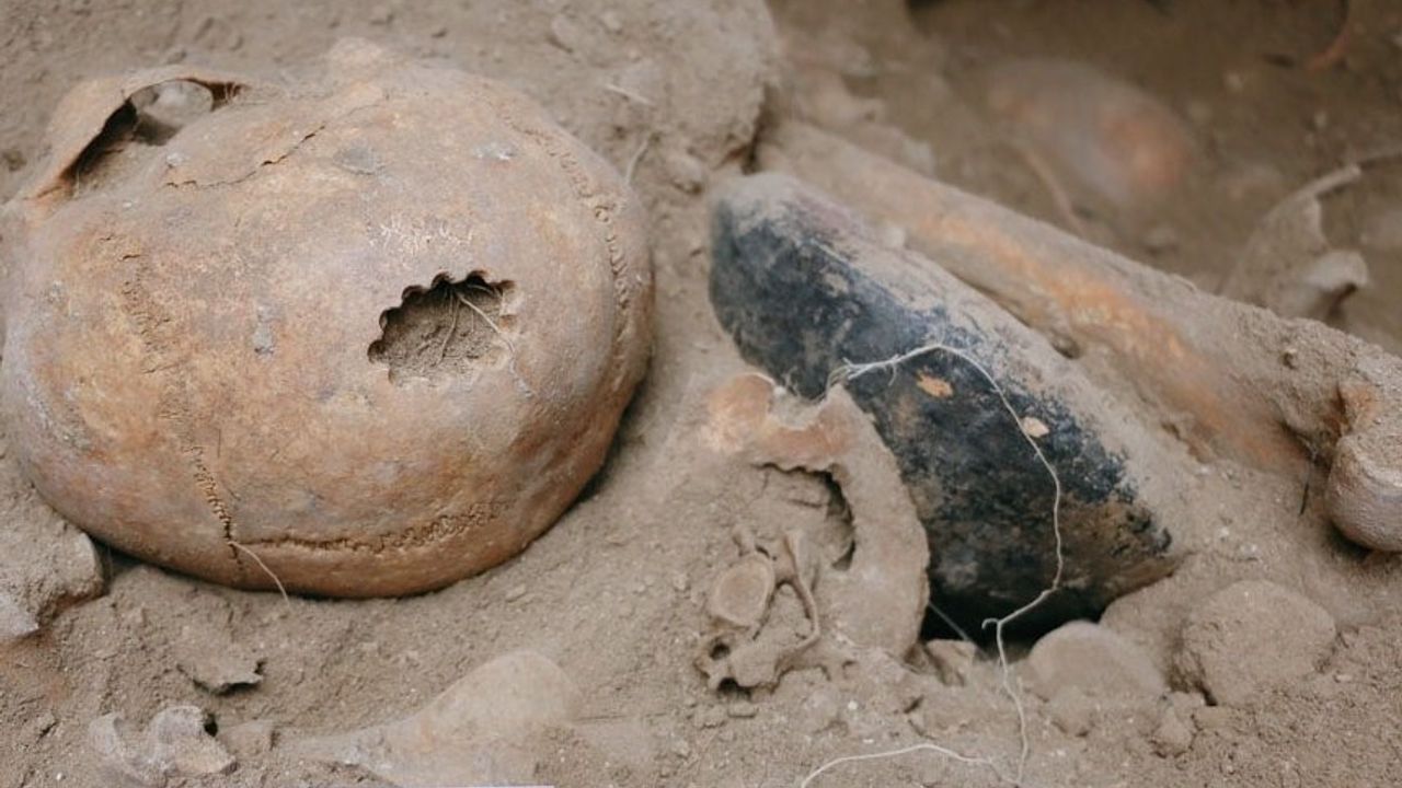 Van’da yeni keşif: 11 delgili bir trepanasyon örneği bulundu