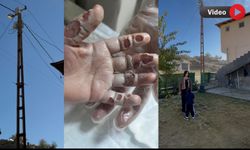 Hakkari’de Bahçedeki Direğe Dokunan 4 Yaşındaki Çocuk ölümden döndü