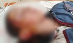 Köpek saldırısında yaralanan çocuk için 1 milyon 200 bin tazminat