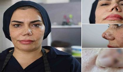 İyileşmek için geçirdiği 4 operasyon sonrası hayatı kabusa döndü