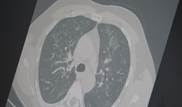 Profesör açıkladı: "3’lü salgın ülkemizde, dikkatli olun"