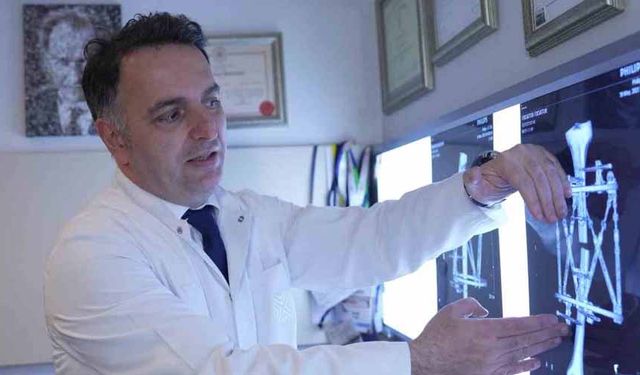 Boy kısalığına karşı modern çözüm: kemik uzatma yöntemleri