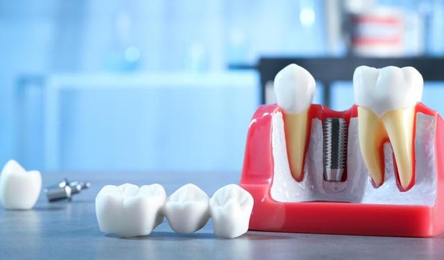 YÜKSEKOVA DEVLET HASTANESİ- TEK ÇENE KRON KÖPRÜ PROTEZ HİZMET ALIMI