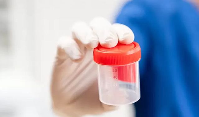 HAKKARİ DEVLET HASTANESİ- İDRARDA UYUŞTURUCU TARAMA TESTİ