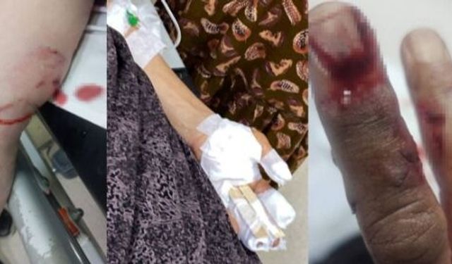 Şırnak’ta başıboş köpek dehşeti: 3 kişi yaralandı