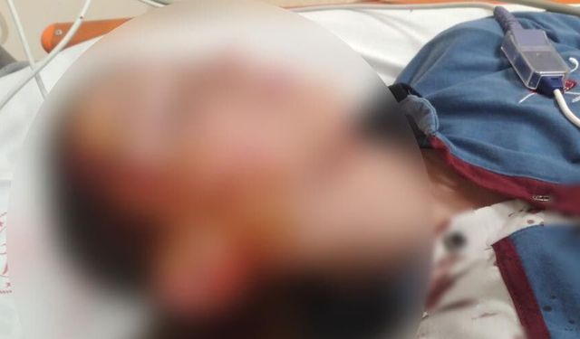 Köpek saldırısında yaralanan çocuk için 1 milyon 200 bin tazminat