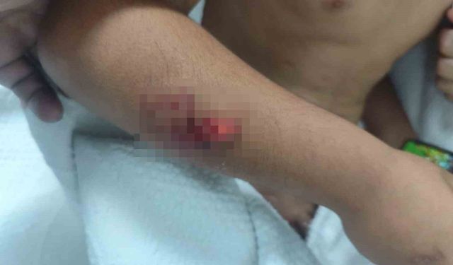 Köpek saldırısına uğrayan çocuğun başına 15 dikiş atıldı