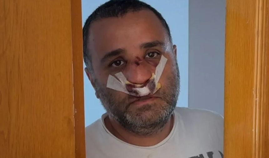 Çocuklarının yanında saldırıya uğrayan baba ilk kez konuştu!