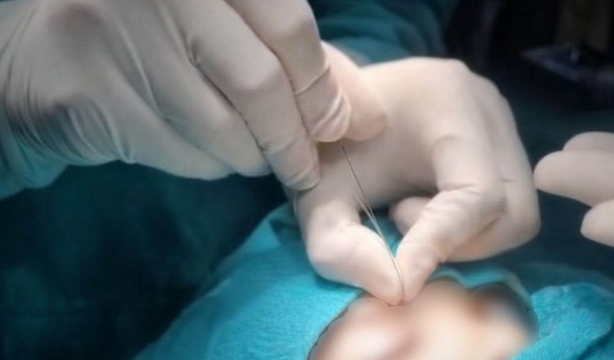 Çukurca’da gözyaşı kanalı ameliyatları yapılmaya başlandı